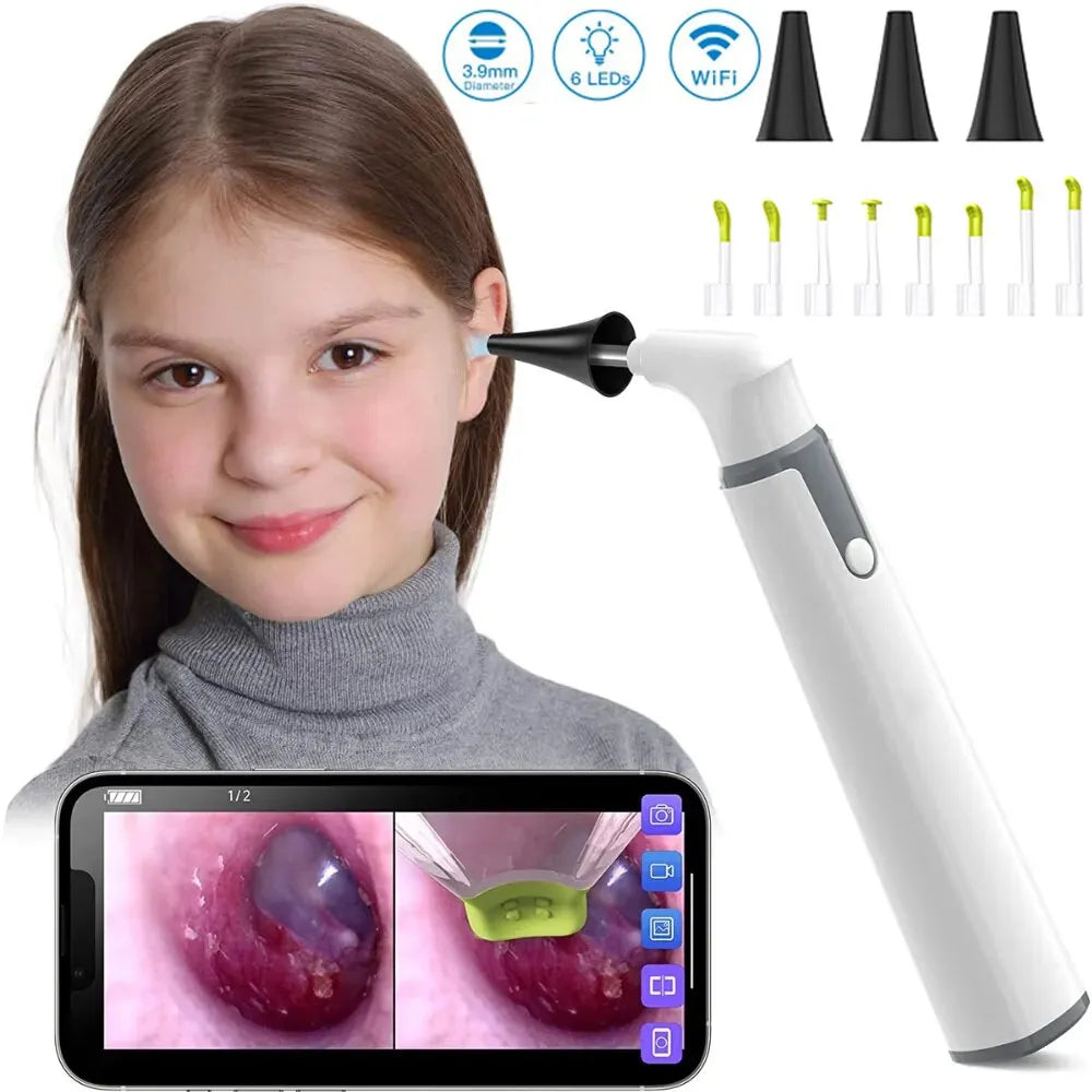 Ear Camera Endoscope 3.9mm Wireless Otoscope 720P HD WiFi Ear Scope with 6 LED for Kids and Adults Support Android iPhone IP67