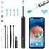 Wireless Wi-fi Visual Ear Cleaner Otoscope Ear Wax Ear with Ear 1296P HD Cleaning Kit Removal Sticks Endoscope Camera Tool Kit